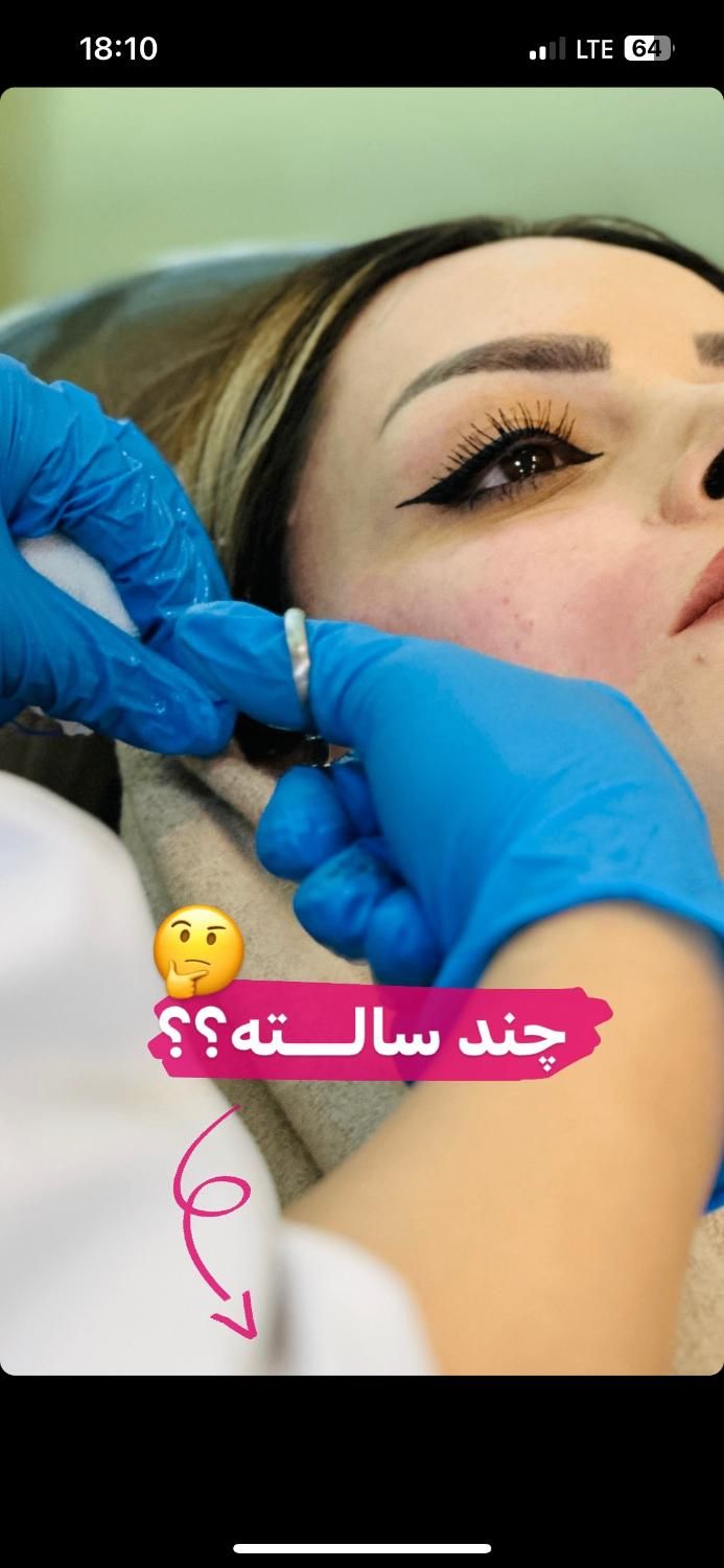 ریموو تاتو/ریزش سکه ای/مزوتـراپی/خال بـرداری/فیشال|خدمات آرایشگری و زیبایی|شیراز, طلاب|دیوار