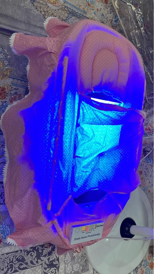 اجاره دستگاه فتوتراپی در منزل|پزشکی|تهران, جی|دیوار