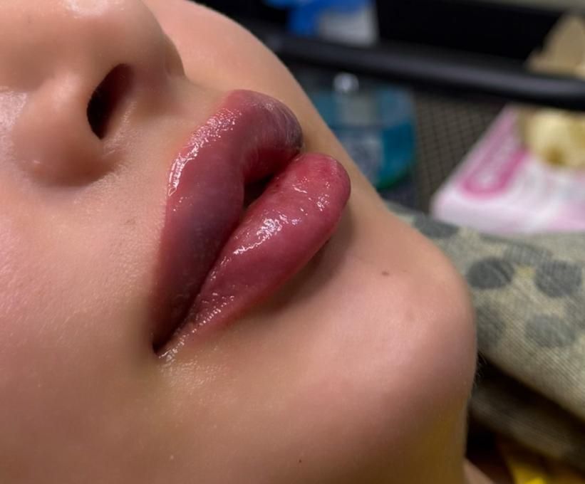 ژل و بوتاکس کلینیک زیبایی دکترفرشیدکریمی|خدمات آرایشگری و زیبایی|کرمانشاه, |دیوار