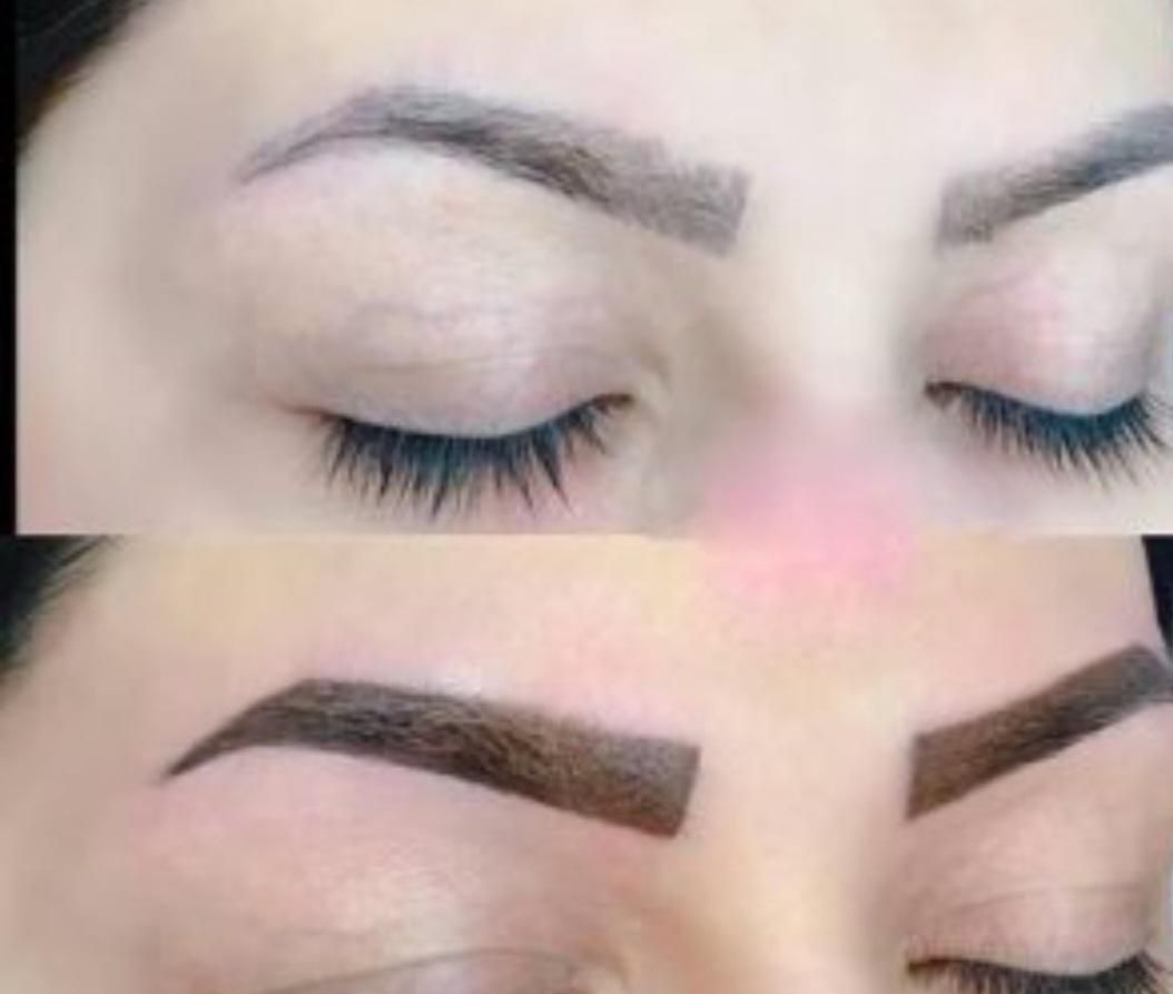 حذف انواع تاتو و خالکوبی با کیوسوئیچ|خدمات آرایشگری و زیبایی|برازجان, |دیوار