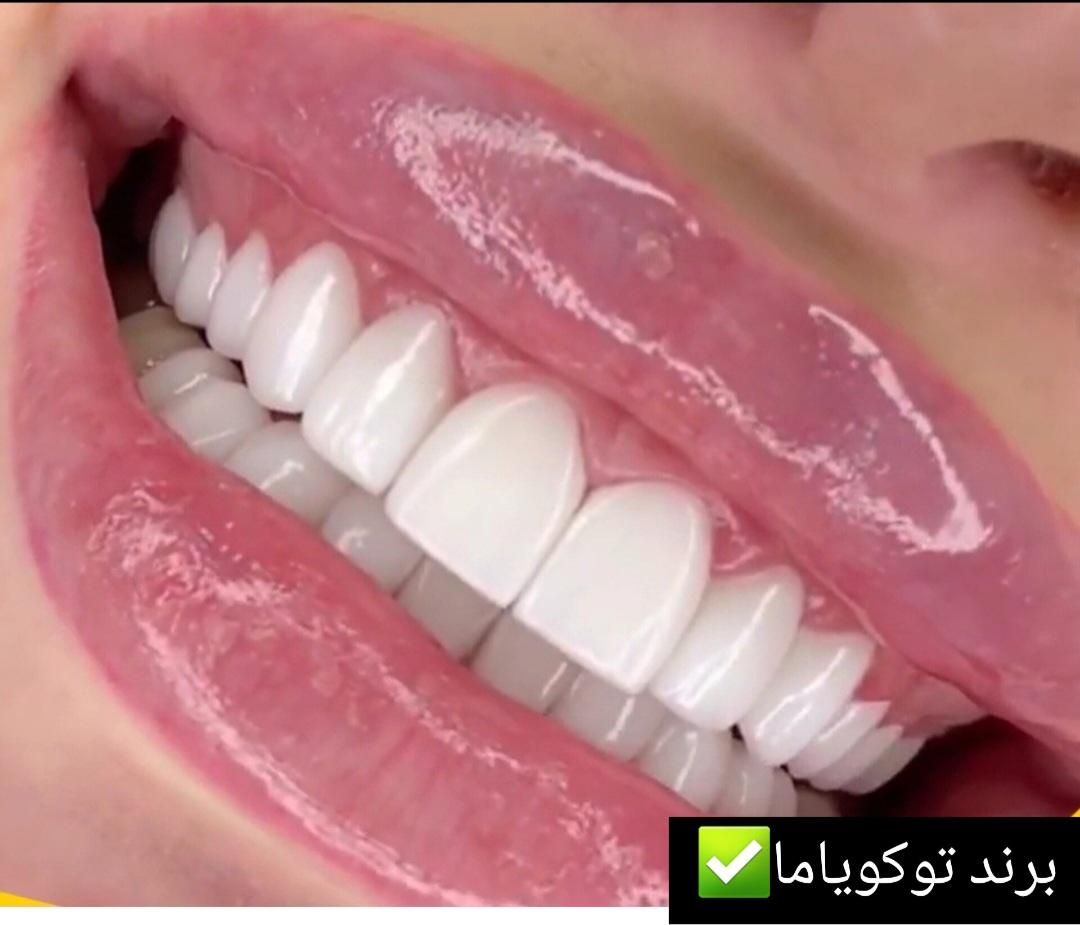 کامپوزیت دندان، روکش، دندانپزشکی تخصصی صدف تهرانسر|خدمات آرایشگری و زیبایی|تهران, تهرانسر مرکزی|دیوار