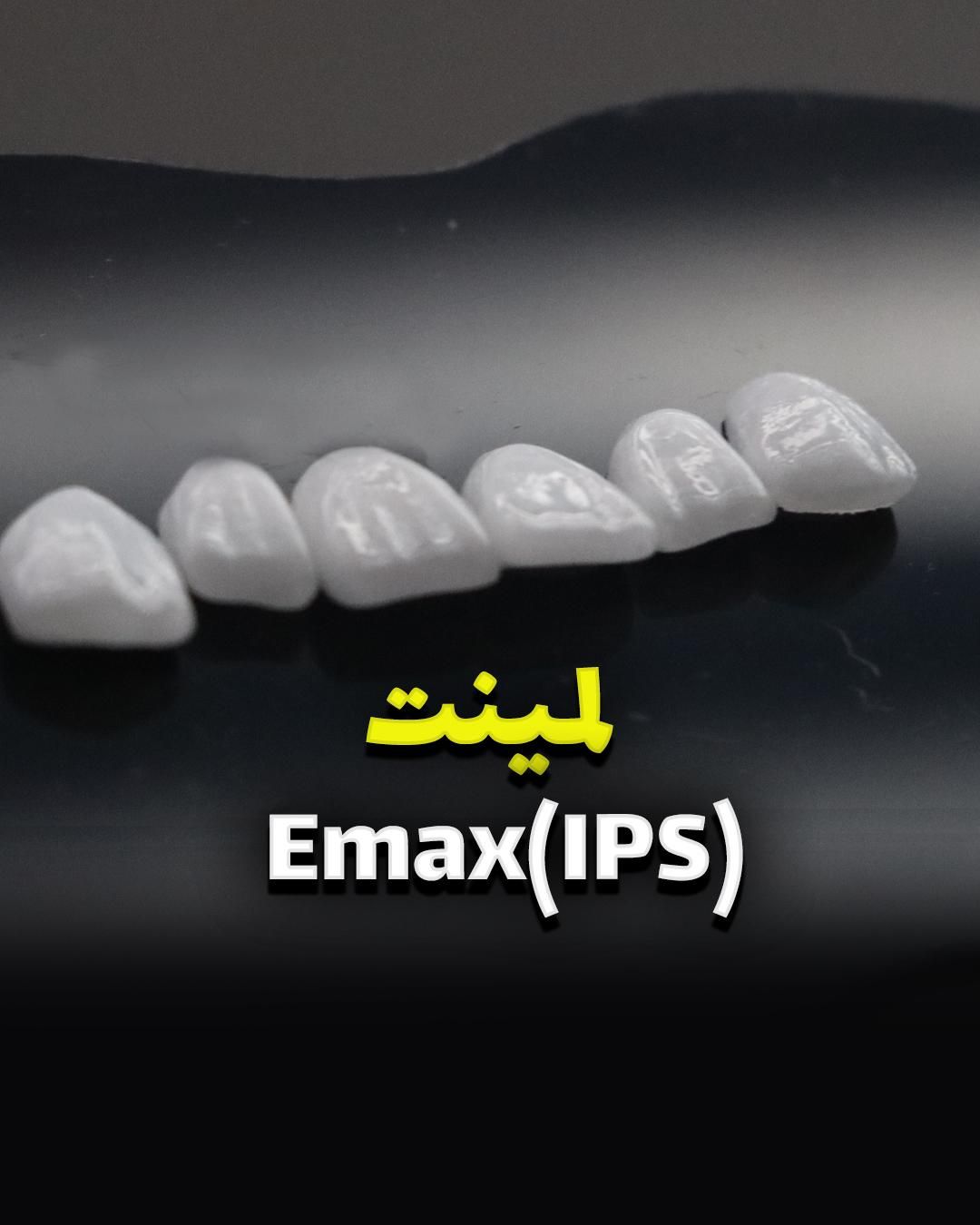 روکش زیرکونیا/ایمپلنت کره ای/ونیر|خدمات آرایشگری و زیبایی|بابل, |دیوار