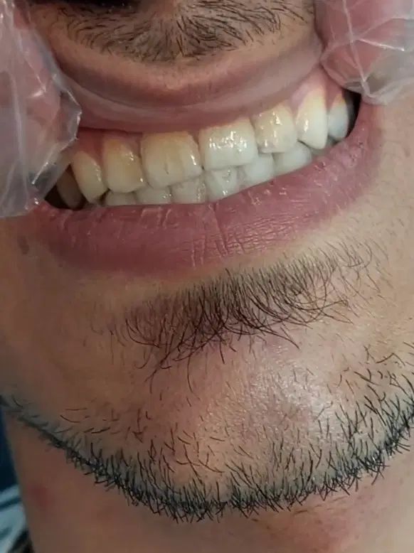 دندانپزشکی با تخفیف ٪40|خدمات آرایشگری و زیبایی|بروجرد, |دیوار