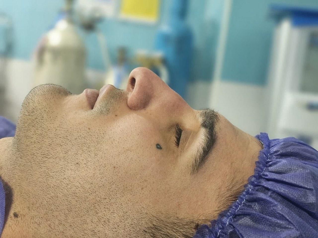 عمل زیبای بینی|خدمات آرایشگری و زیبایی|قائم‌شهر, |دیوار