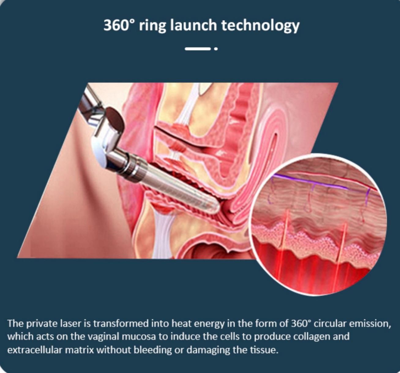 لابیاپلاستی‌ تایتنینگ‌ وایتنینگ با لیزرco2 فرکشنال|خدمات آرایشگری و زیبایی|ارومیه, |دیوار