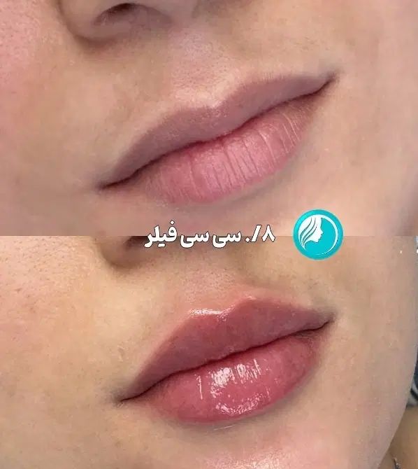 میکرو بلید ابرو|خدمات آرایشگری و زیبایی|مشهد, کوی المهدی|دیوار