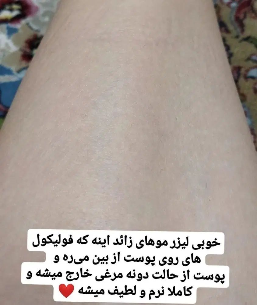لیزر موهای زائد و پاکسازی صورت فقط 500 تومن|خدمات آرایشگری و زیبایی|اسلام‌شهر, زرافشان|دیوار