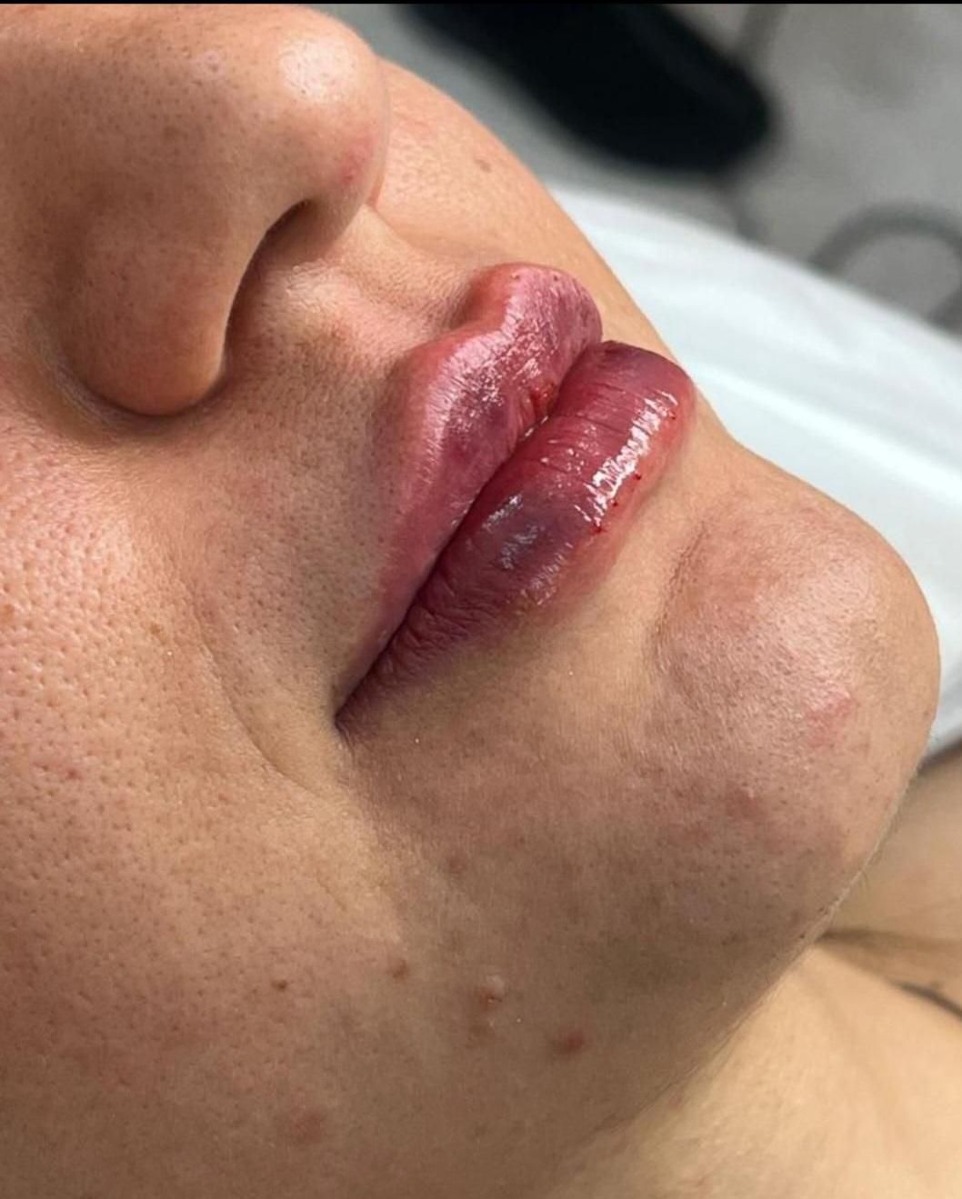 مرکز لیزر و زیبایی دکتر فروغ احمدی پور|خدمات آرایشگری و زیبایی|پردیس, فاز ۴|دیوار