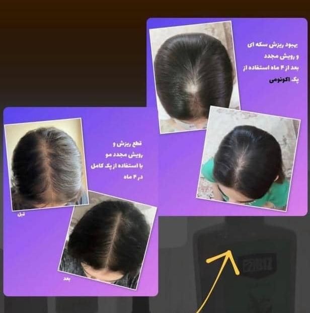 محلول گیاهی ضد ریزش مو و رویش مجدد|آرایشی، بهداشتی، درمانی|شیراز, بهارستان|دیوار