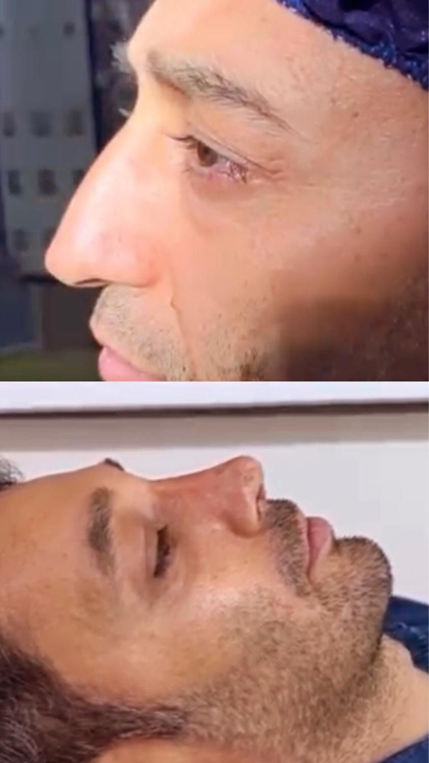 عمل بینی بندرعباس،اقساطی،باکیفیت و تضمین|خدمات آرایشگری و زیبایی|بندرعباس, |دیوار