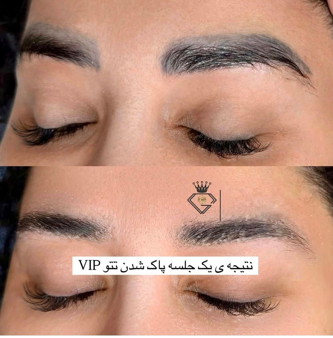 ریمو کاملا تخصصی تضمینی با مدرس بین الملی|خدمات آرایشگری و زیبایی|آبادان, |دیوار