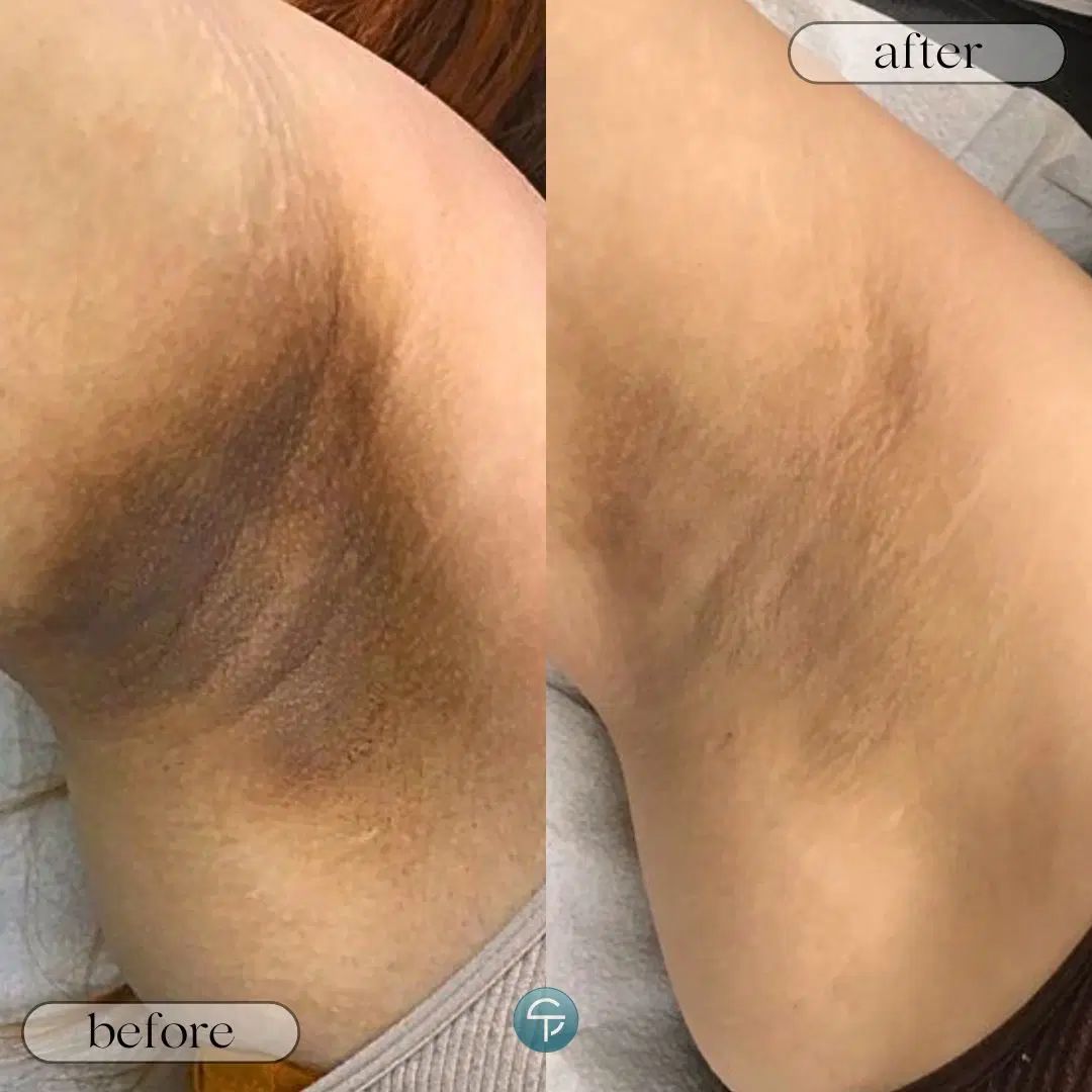 خدمات لیزر و رفع تیرگی و لاغری باتخفیف ویژه|خدمات آرایشگری و زیبایی|بجنورد, |دیوار