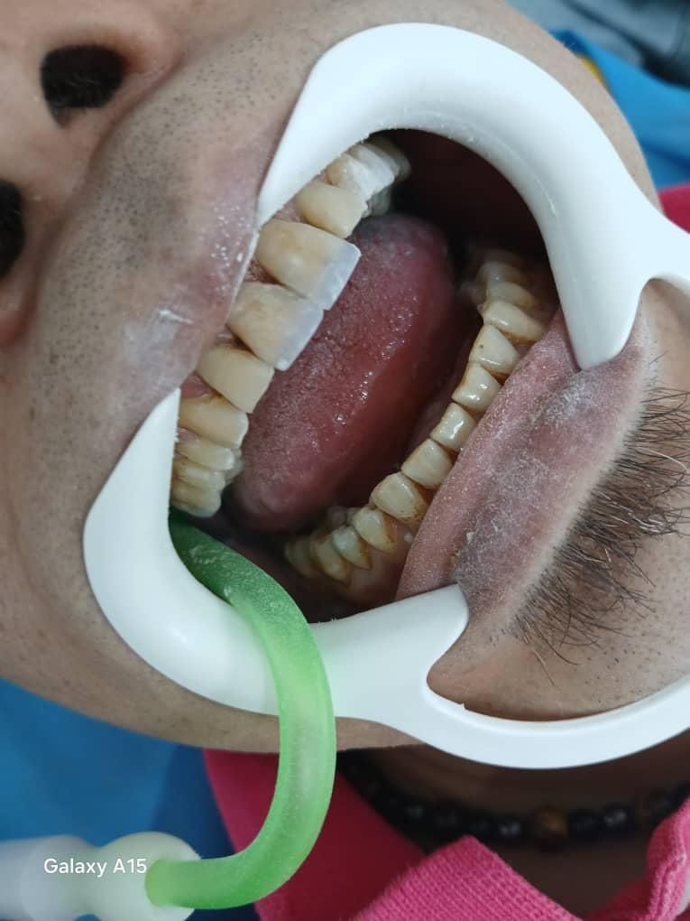 آموزش دندانپزشکی کامپوزیت|خدمات آموزشی|تهران, شهرک شریعتی|دیوار