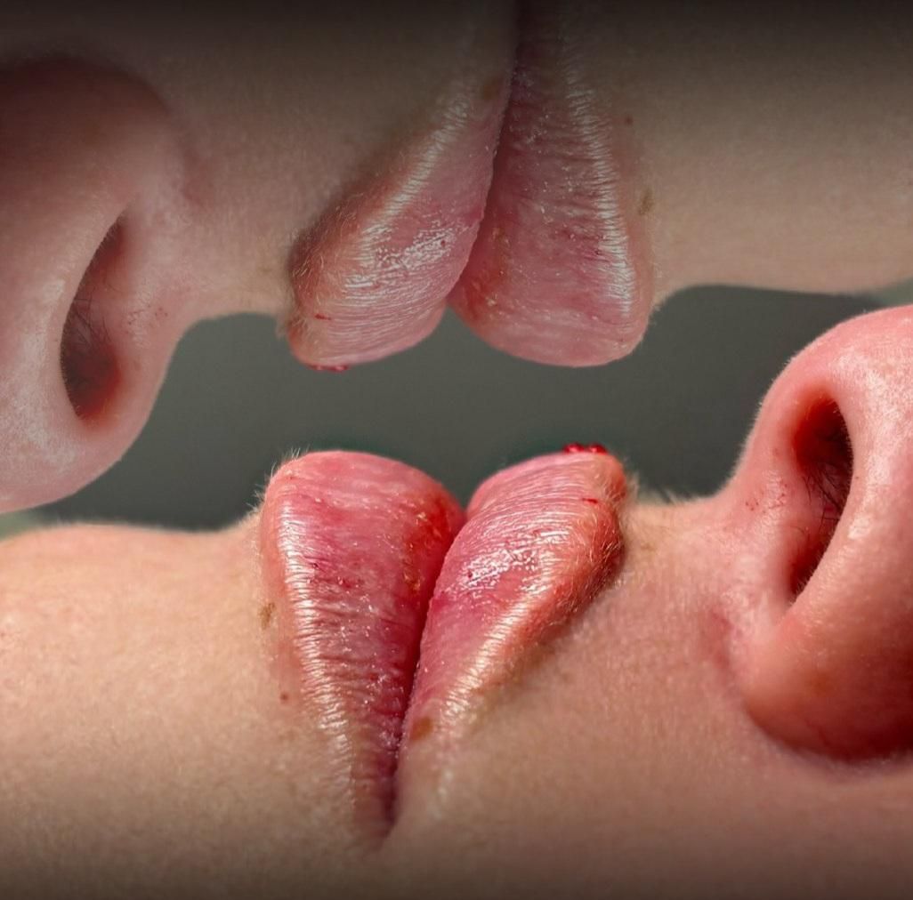 آموزش پیشرفته فیلر(ژل)،بوتاکس،لیفت نخ|خدمات آموزشی|تهران, نیاوران|دیوار