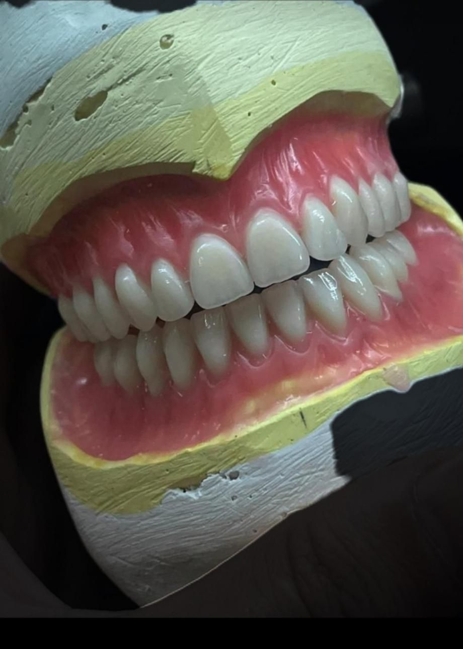 خدمات دندان مصنوعی (پروتز متحرک)|آرایشی، بهداشتی، درمانی|پارسآباد, |دیوار