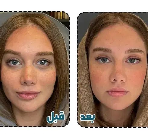 مدل خدمات فول فیس (رایگان) خانم و آقا|خدمات آرایشگری و زیبایی|تهران, جردن|دیوار