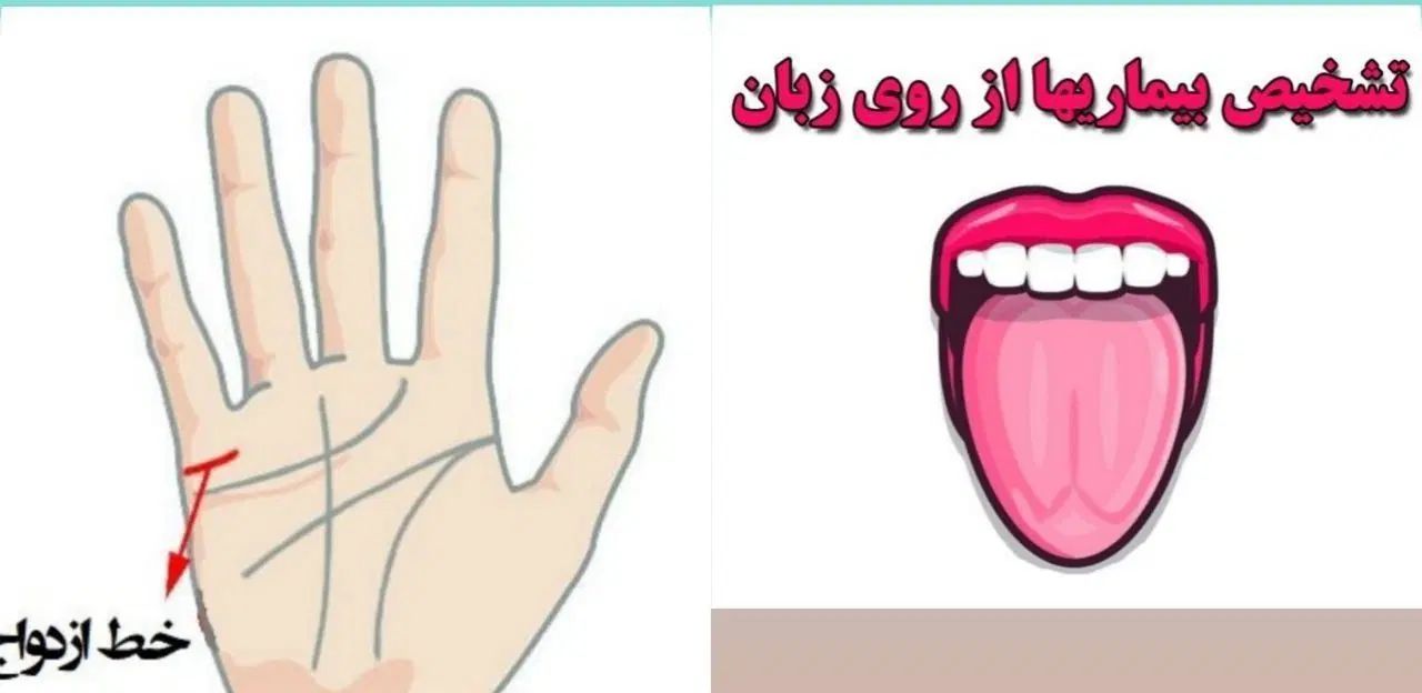 تشخیص عارضه ها ازروی عکس زبان|آرایشی، بهداشتی، درمانی|رشت, بلوار گیلان|دیوار