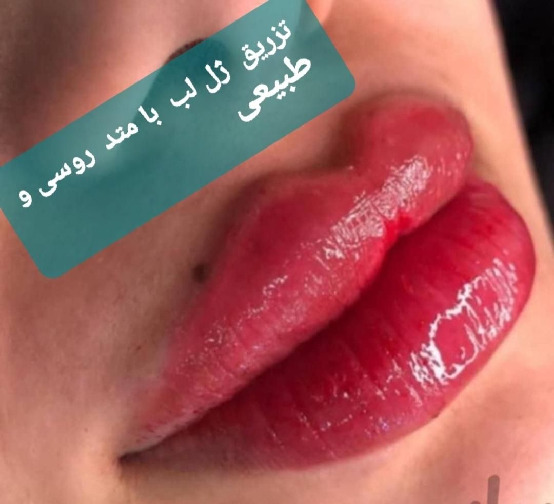 آموزش خدمات زیبایی  تزریق ژل .فیلر .بوتاکس .چربی|خدمات آموزشی|رشت, گلسار|دیوار