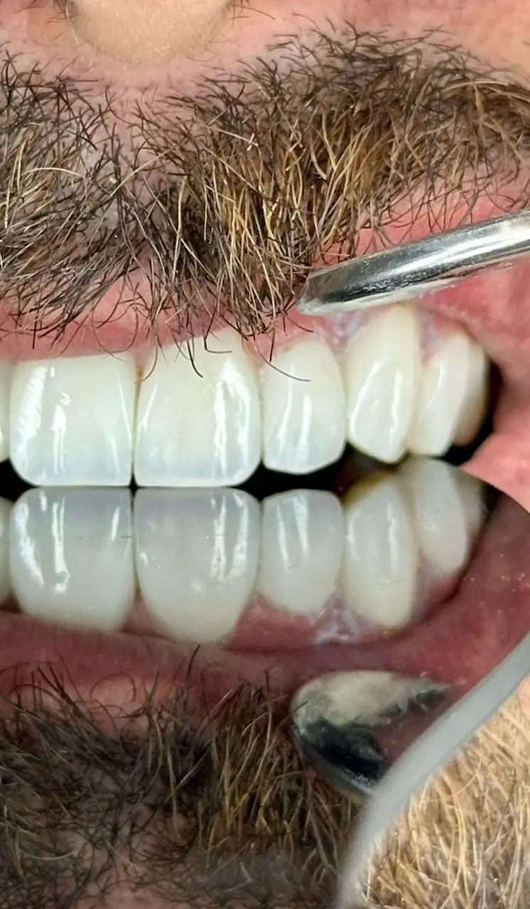 دندانپزشکی اقساط ۱۲ماهه بدون پیش پرداخت|خدمات آرایشگری و زیبایی|تهران, خانی آباد نو شمالی|دیوار