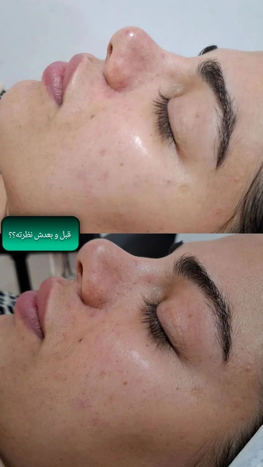 فیشیال تخصصی با بهترین برندو متریال کره ای|خدمات آرایشگری و زیبایی|رامهرمز, |دیوار