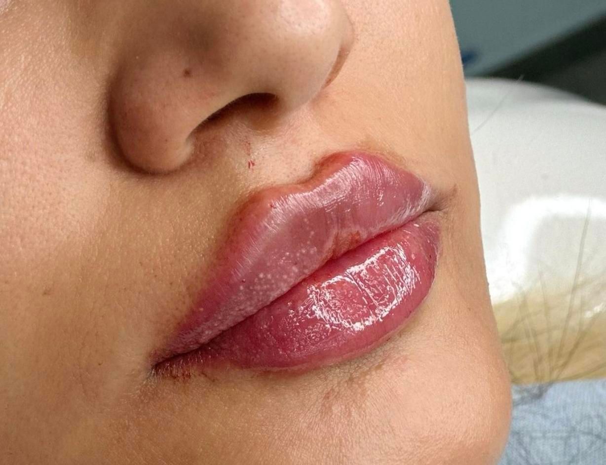 تزریق انواع بوتاکس ژل آنزیم بینی نخ جوانسازی|خدمات آرایشگری و زیبایی|صدرا-فارس, فاز ۱|دیوار