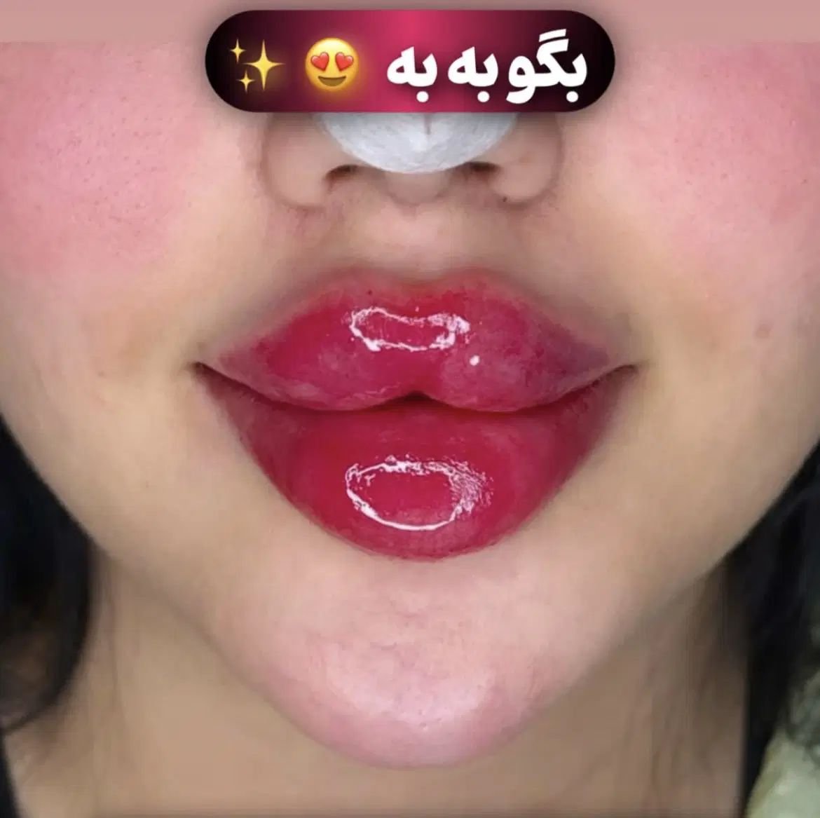 ژل لب بوتاکس فیلر انزیم کامپوزیت دندان|خدمات آرایشگری و زیبایی|مشهد, راهنمایی|دیوار