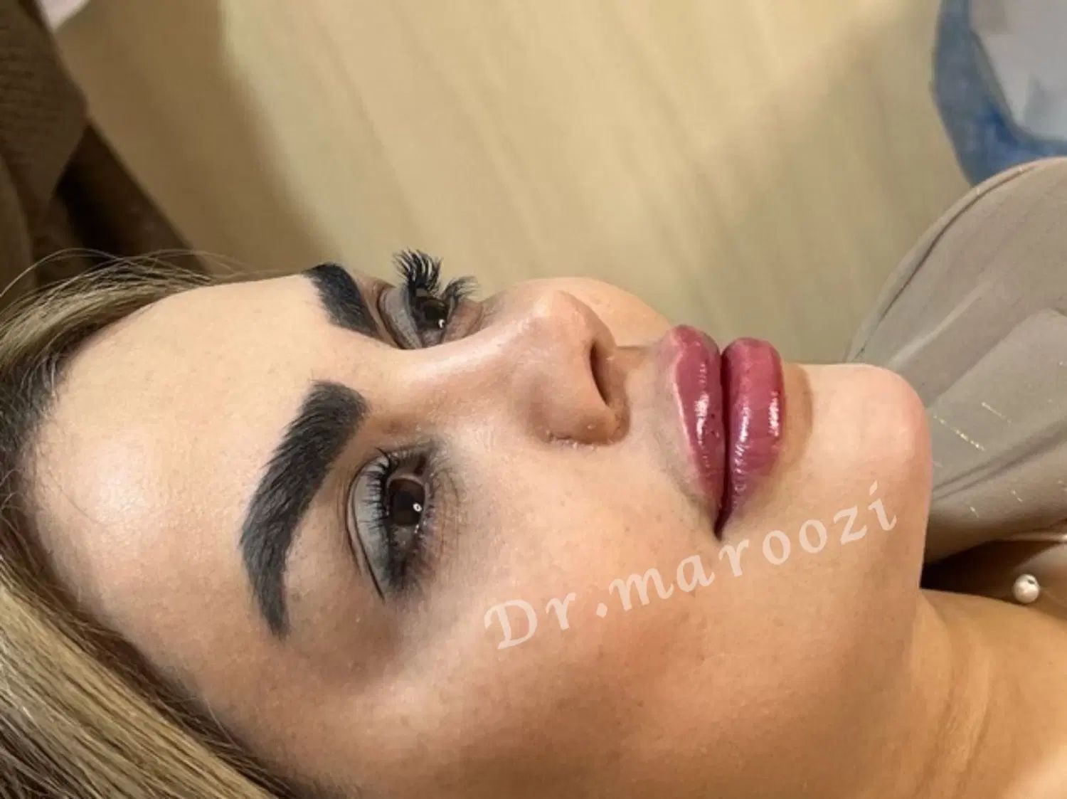 تزریق ژل لب بوتاکس لیفت ابرو کانتورینگ و آموزش|خدمات آرایشگری و زیبایی|تهران, پونک|دیوار