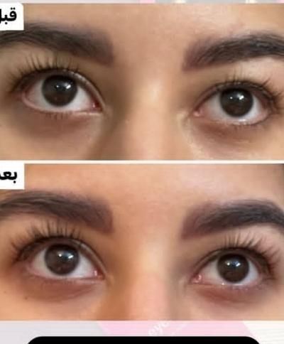 سرم مژه معجزه گر|آرایشی، بهداشتی، درمانی|اصفهان, گلستان|دیوار