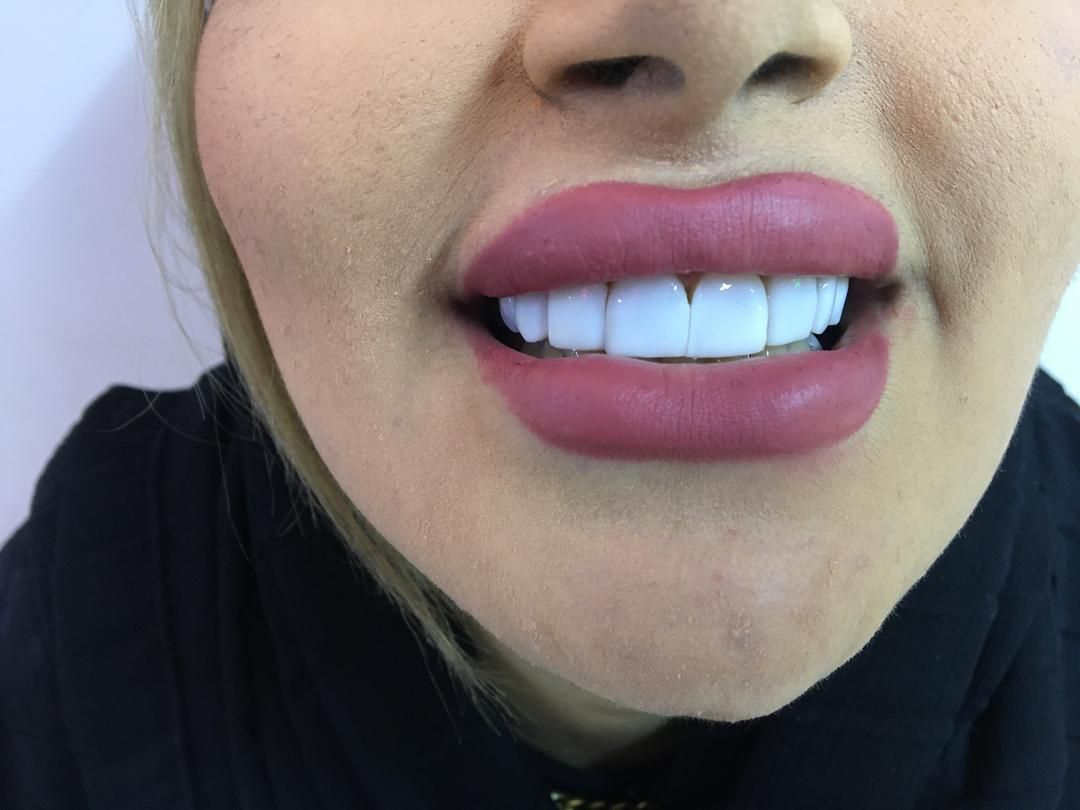 دندانپزشکی انجام تمامی خدمات دندانپزشکی|خدمات آرایشگری و زیبایی|تبریز, |دیوار