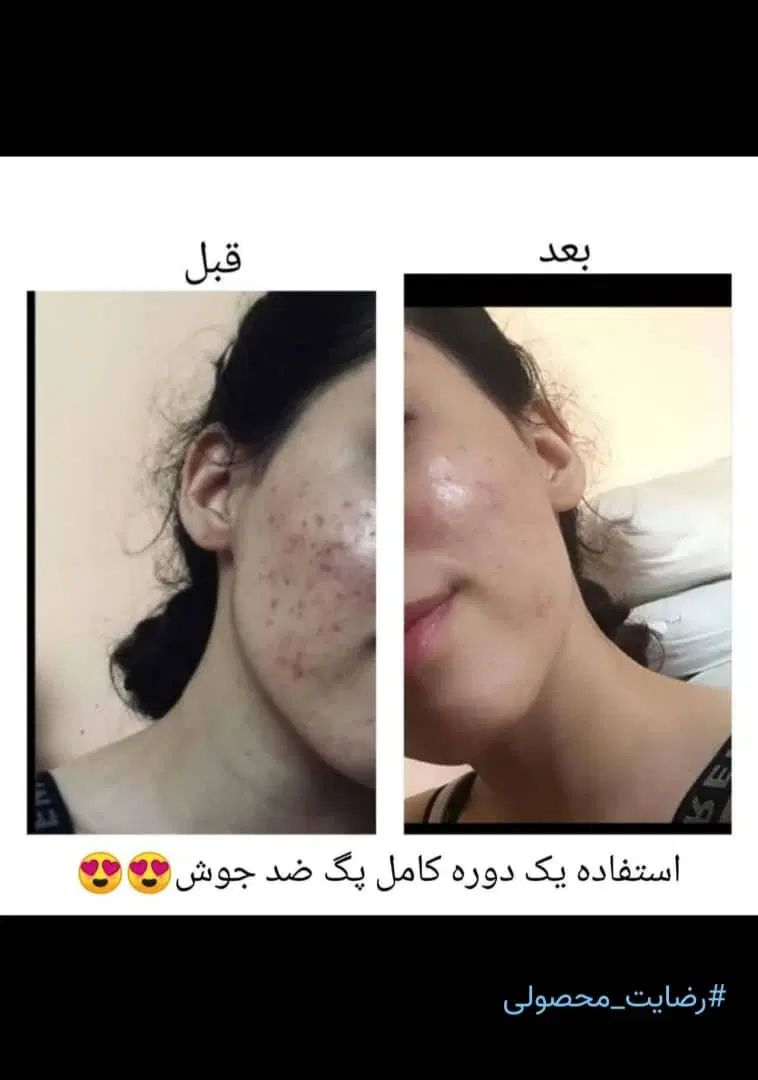 فیشیال صورت بانوان|خدمات آرایشگری و زیبایی|اصفهان, کارلادان|دیوار
