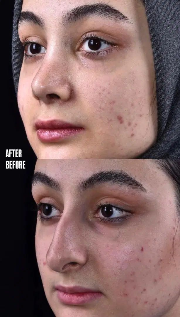 جراحی بدون نقص و متفاوت|خدمات آرایشگری و زیبایی|تهران, ازگل|دیوار