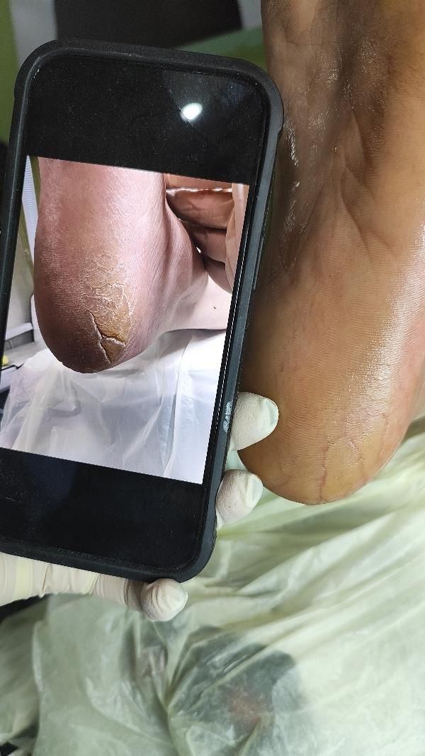 اموزش حرفه پدیکور خشک و خیس|خدمات آموزشی|یزد, |دیوار