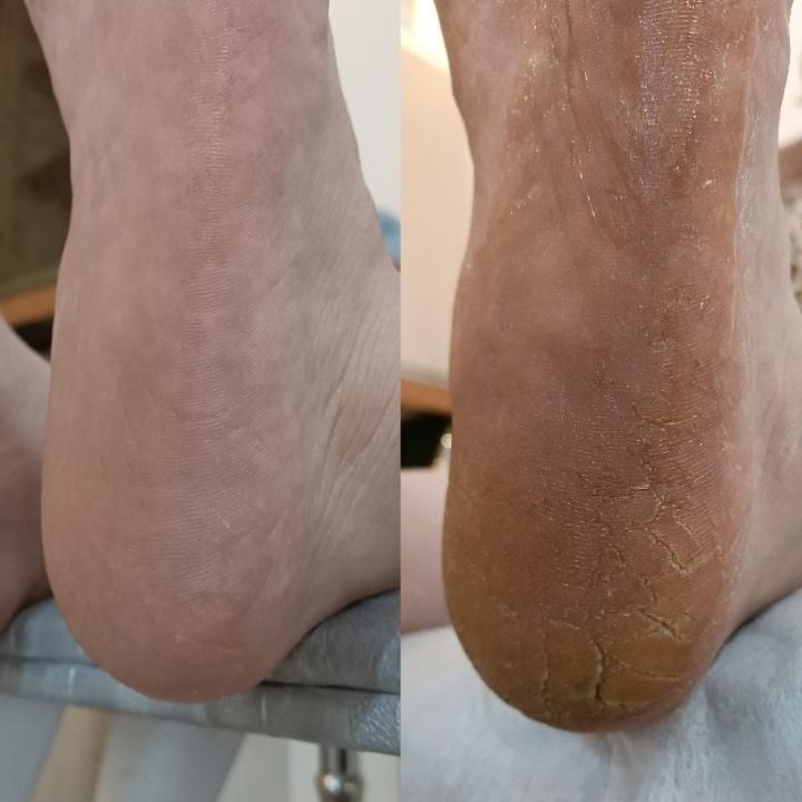 پدیکور تخصصی  و فشیال فردیس|خدمات آرایشگری و زیبایی|فردیس, فردیس|دیوار