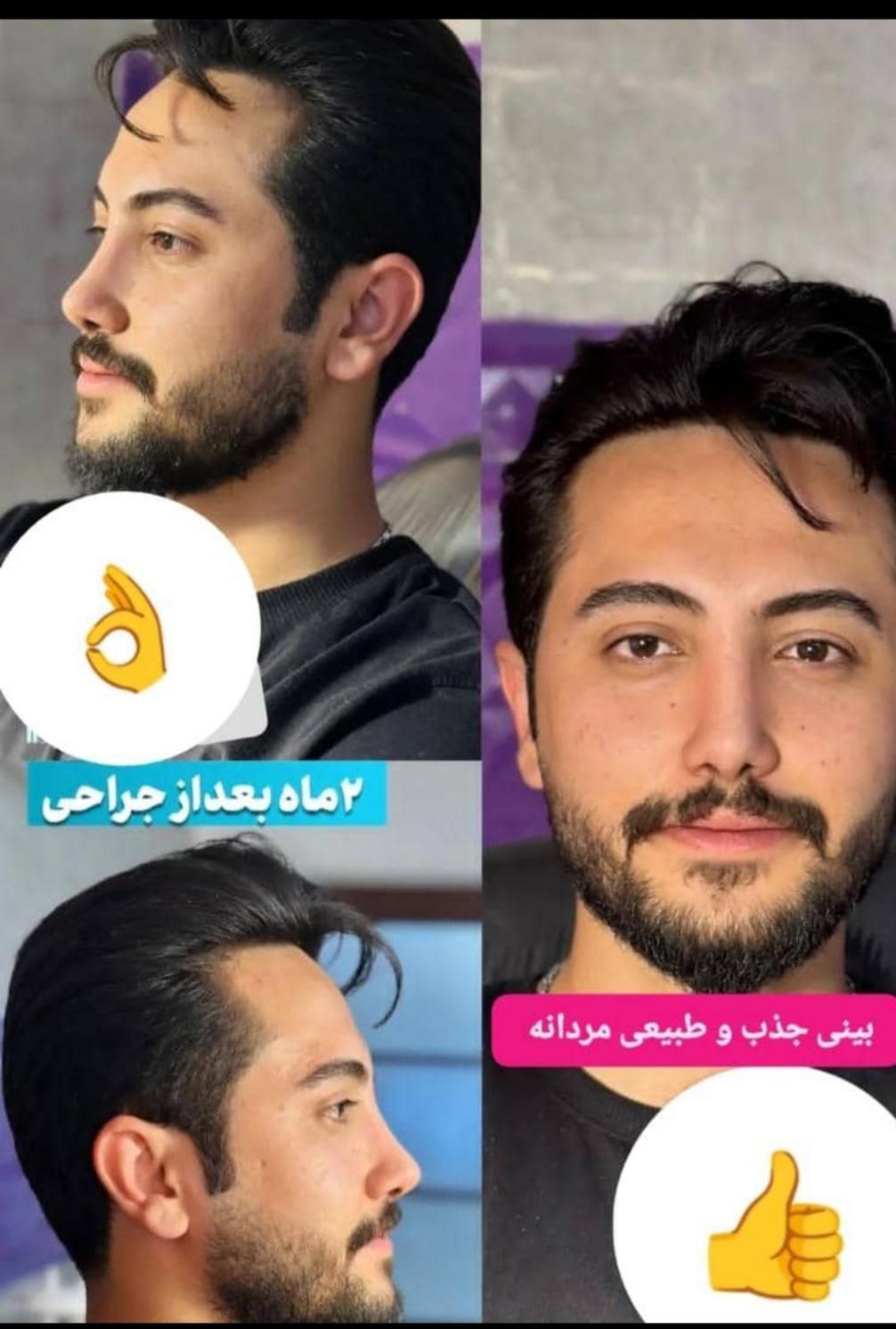 عمل جراحی بینی، ترمیمی،  لیفت صورت،  لیپو ابدو|خدمات آرایشگری و زیبایی|تهران, نارمک|دیوار