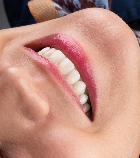 دندانپزشکی، لمینت،ایمپلنت ،دیجیتال،نقدواقساط|خدمات آرایشگری و زیبایی|مشهد, سناباد|دیوار