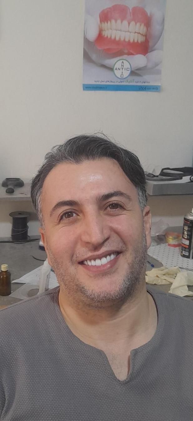 دست دندان مصنوعی با کیفیت عالی و قیمت مناسب|خدمات آرایشگری و زیبایی|تهران, دهکده المپیک|دیوار