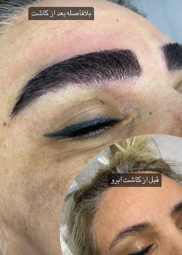 کاشت ابرو طبیعی و حرفه ای در کلینیک معتبر|خدمات آرایشگری و زیبایی|تهران, سهروردی|دیوار