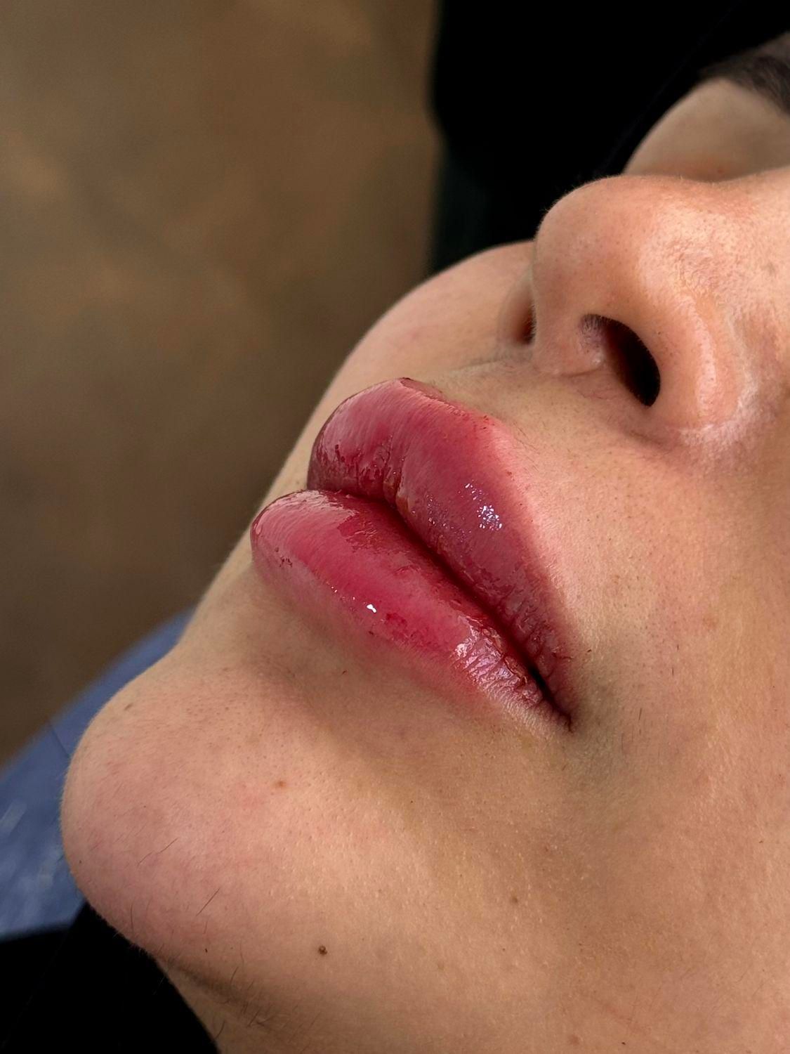 تزریق ژل و بوتاکس با بروزترین تکنیک ها|خدمات آرایشگری و زیبایی|ارومیه, |دیوار