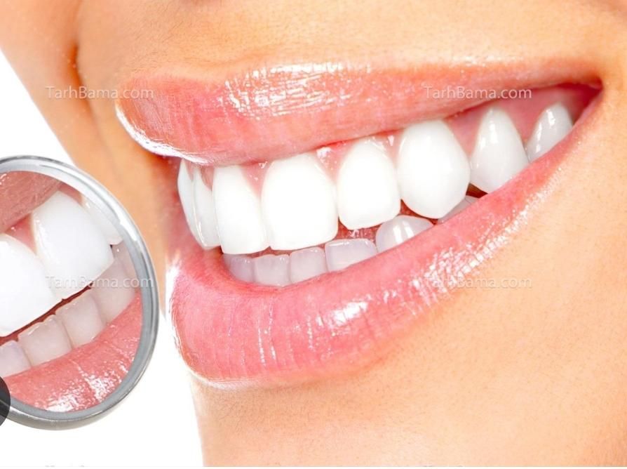 جشنواره دندانپزشکی،ایمپلنت و ...|خدمات آرایشگری و زیبایی|مشهد, جنت|دیوار