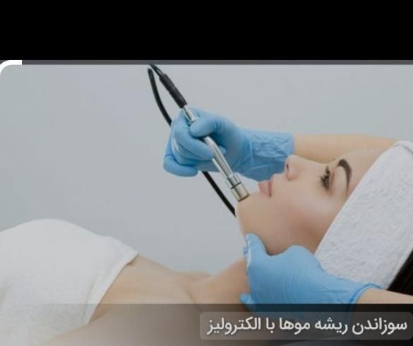 الکترولیز|خدمات آرایشگری و زیبایی|شیراز, میانرود|دیوار