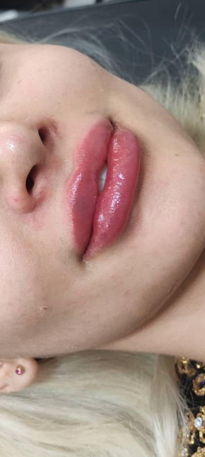 ژل بوتاکس|خدمات آرایشگری و زیبایی|دوگنبدان, |دیوار