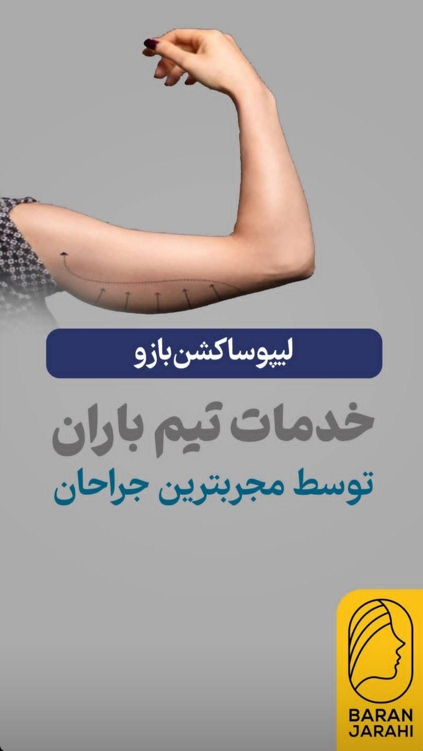 لیپوماتیک و ابدو مینو پلاستی ۳۶۰. مامو پلاستی|خدمات آرایشگری و زیبایی|شیراز, فرهنگ شهر|دیوار