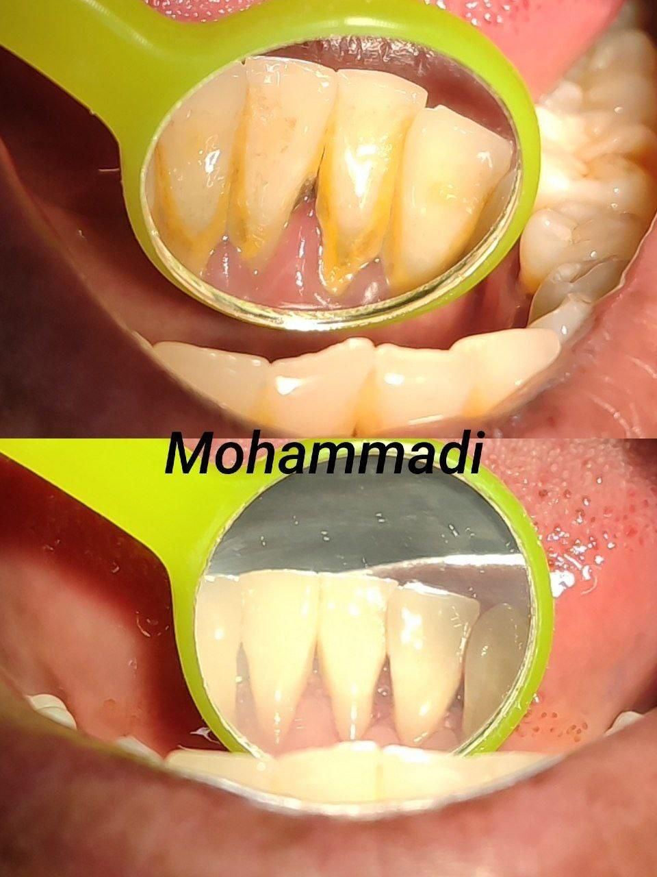 آموزش کامپوزیت ونیر|خدمات آموزشی|تهران, شهرک شریعتی|دیوار