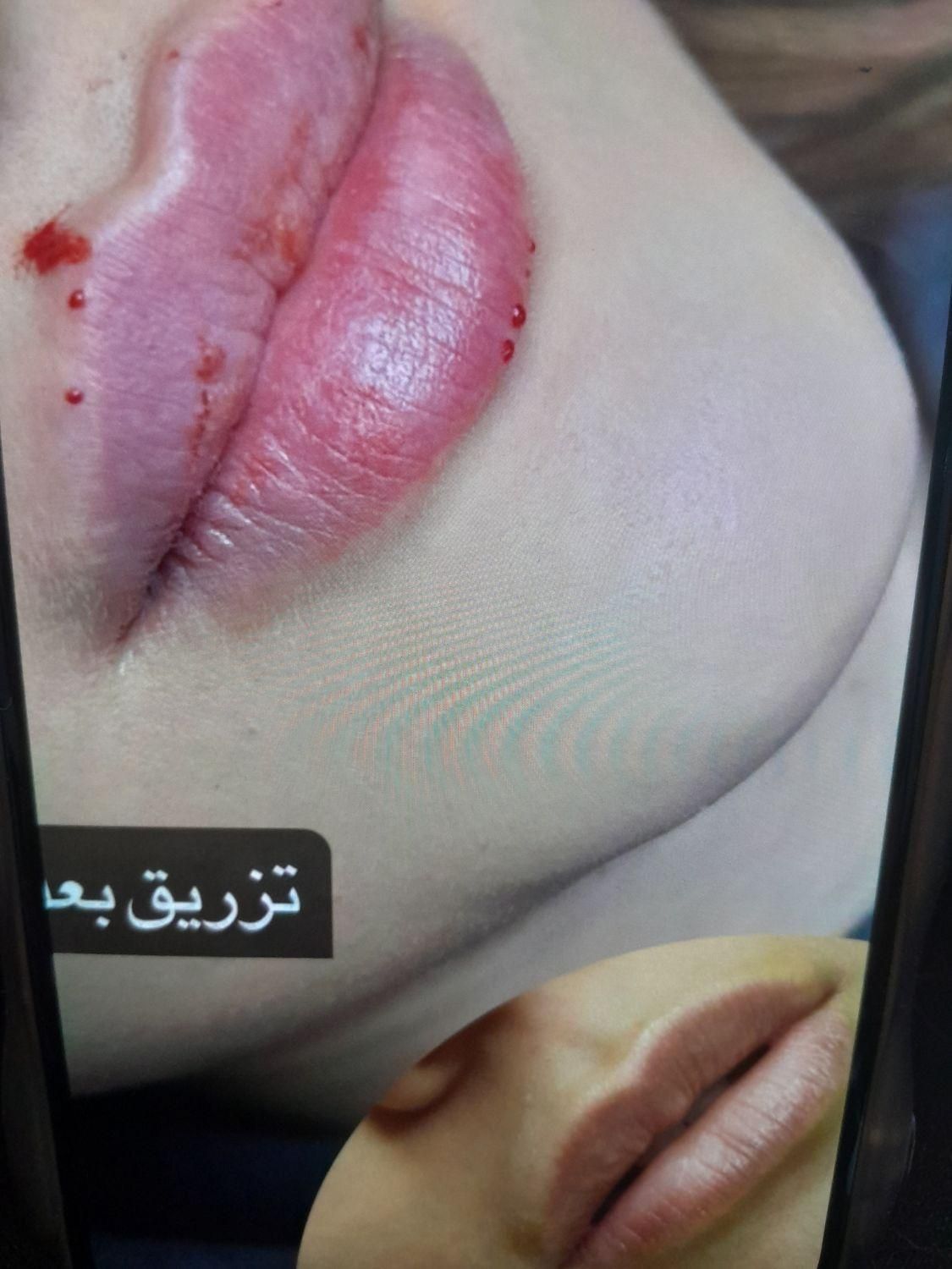لیزر موهای زائدالکساندرایت‌کندلاآمریکایی‌اصل|خدمات آرایشگری و زیبایی|اندیشه, اندیشه فاز ۱|دیوار