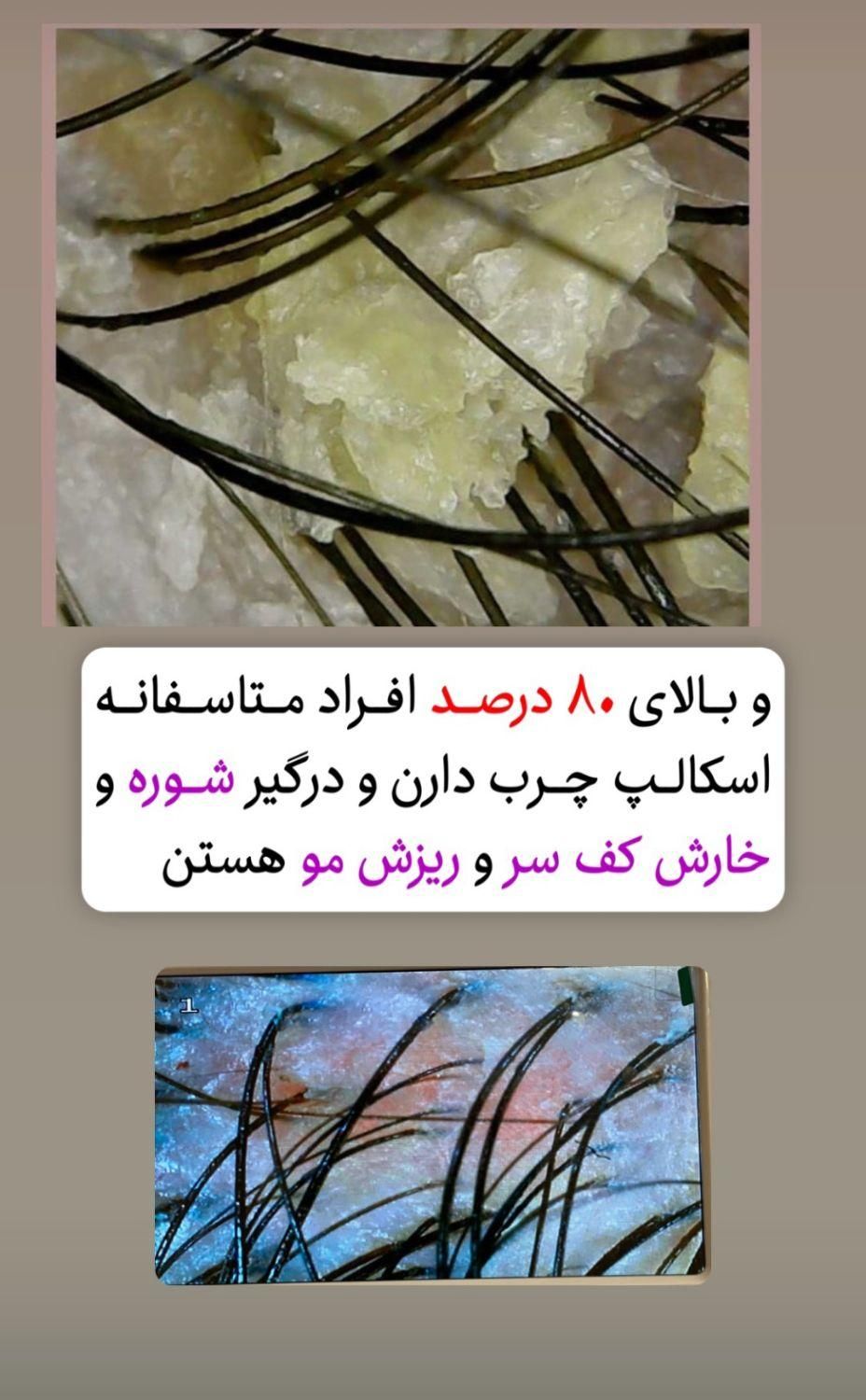 آموزش و خدمات اسکالپ اسکراب|خدمات آرایشگری و زیبایی|شیراز, سینما سعدی|دیوار