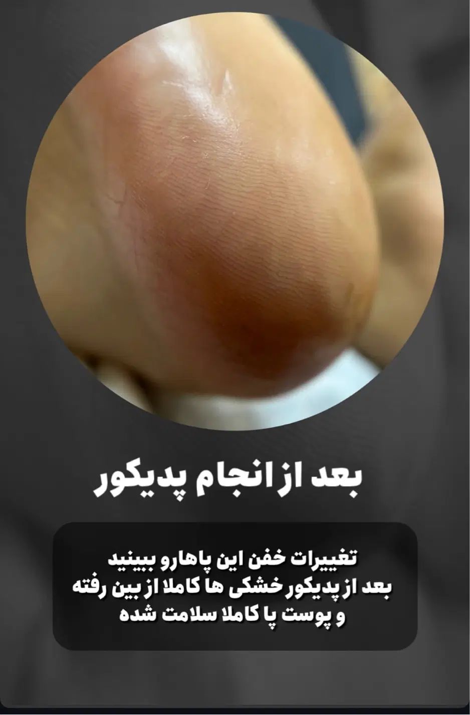 پدیکور تخصصی|خدمات آرایشگری و زیبایی|کرج, اتحاد|دیوار
