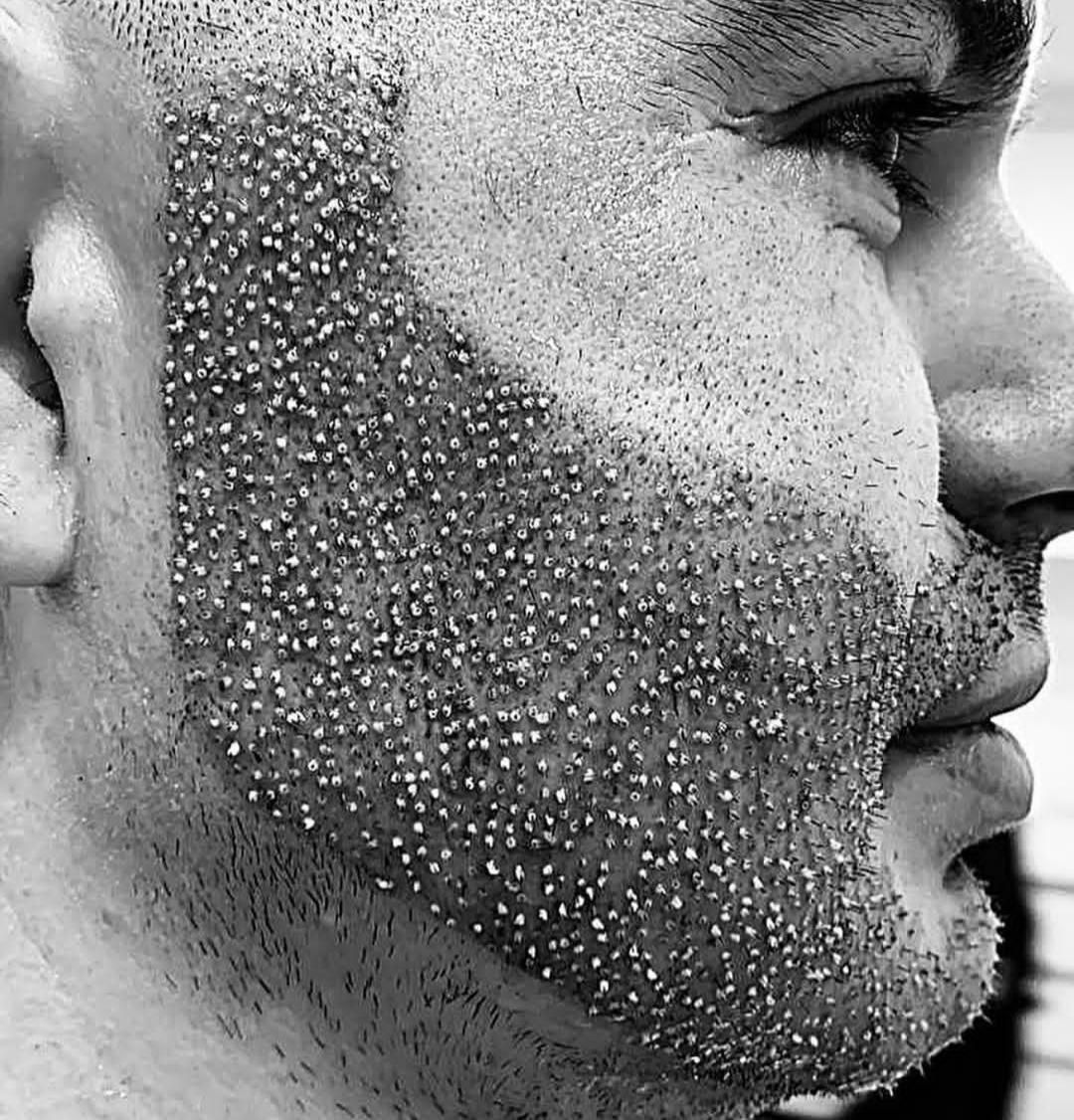 جشنوارهکاشت مو و ابرو و ریش وسبیل|خدمات آرایشگری و زیبایی|اهواز, اسماعیلیه|دیوار