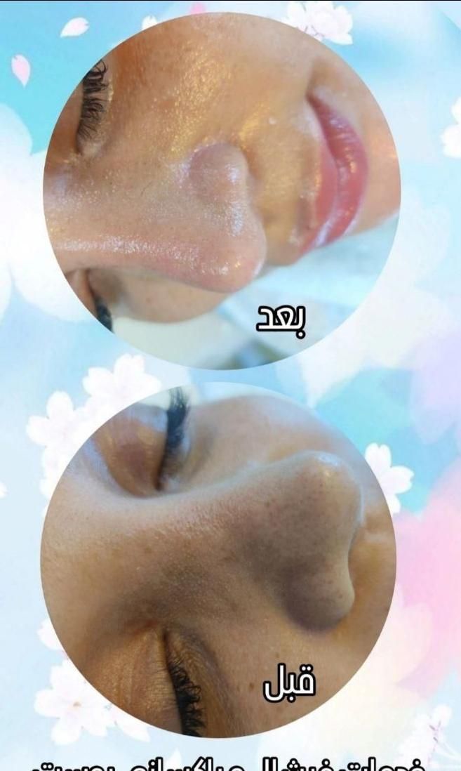 مدل فیشیال ویژه با یکبار فیشیال تغییر رااحساس کنید|خدمات آرایشگری و زیبایی|کرج, گلشهر|دیوار