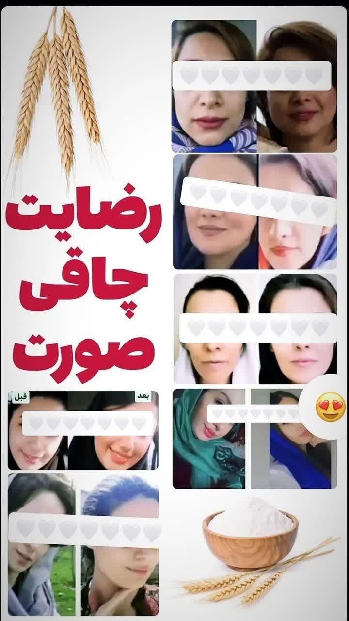 تپلی صورت|آرایشی، بهداشتی، درمانی|رشت, بلوار گیلان|دیوار