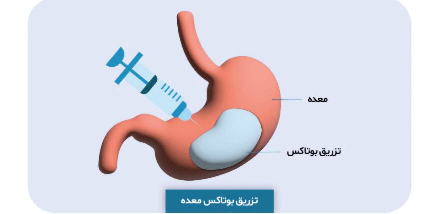 کاهش وزن اصولی و تضمینی|خدمات آرایشگری و زیبایی|تهران, سعادت‌آباد|دیوار